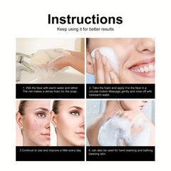African Soap Facial Cleanser for Acne Prone Skin