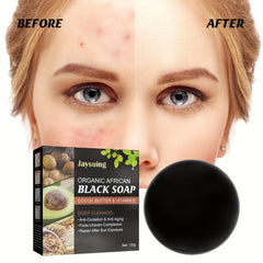 African Soap Facial Cleanser for Acne Prone Skin
