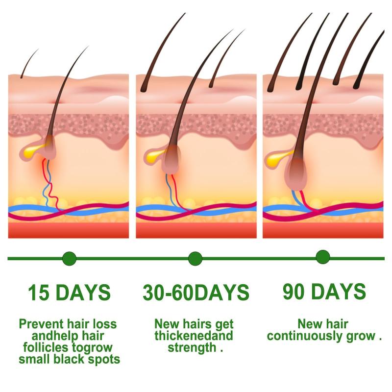 Rosemary Hair Care Solution for Stronger Softer Hair