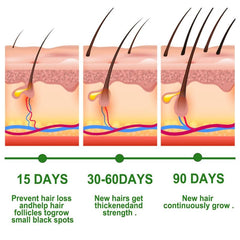Rosemary Hair Care Solution for Stronger Softer Hair
