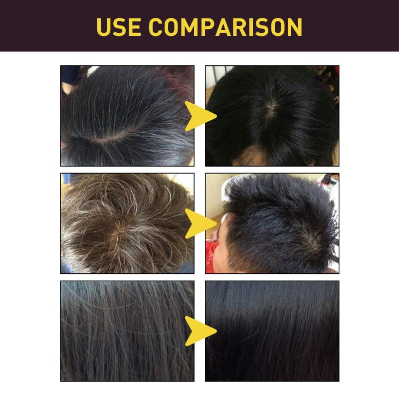100ml Polygonum Multiflorum Hair Shampoo