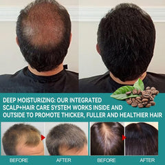 Caffeine Biotin Peptide Density Serum For Hair Care