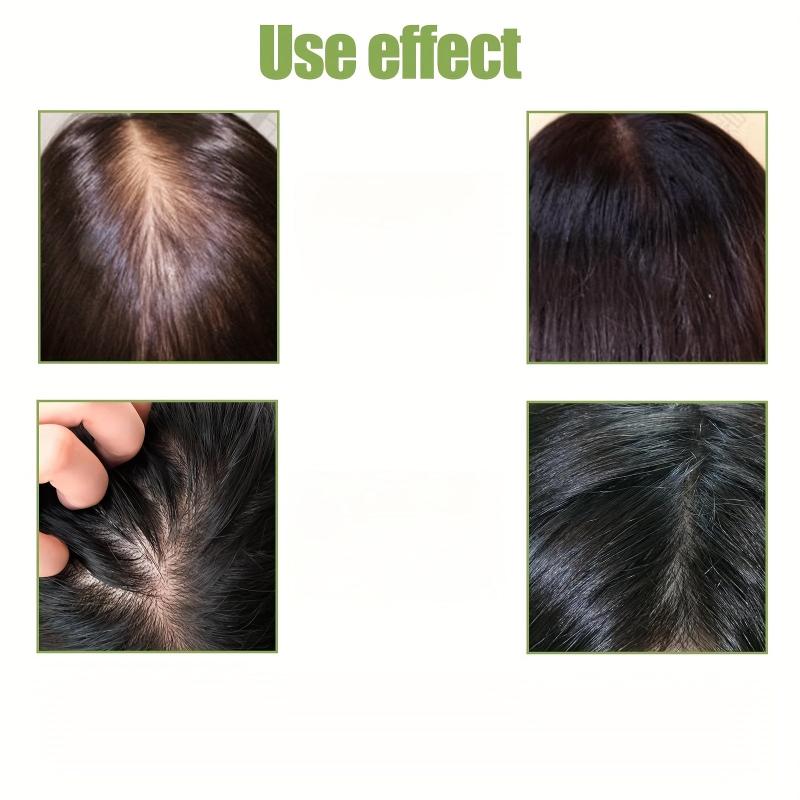 30ml Scalp Serum Hair Massage Essential Strengthens Hair