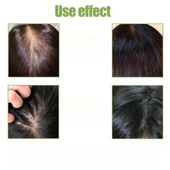 30ml Scalp Serum Hair Massage Essential Strengthens Hair