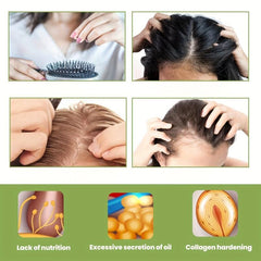 30ml Scalp Serum Hair Massage Essential Strengthens Hair