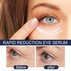 5ml Eye Serum Reduces Eye Bags Wrinkles Dark Circles Fine Redness Crow's Feet