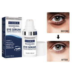 5ml Eye Serum Reduces Eye Bags Wrinkles Dark Circles Fine Redness Crow's Feet