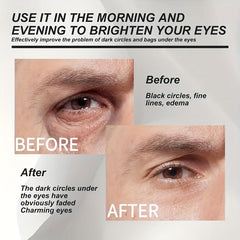 Men's Firming Eye Cream: Reduce Fine Lines, Repair Bags & Dark Circles