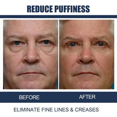 Men's Firming Eye Cream: Reduce Fine Lines, Repair Bags & Dark Circles