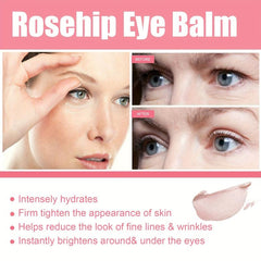 Rose Hip Eye Cream Stick Moisturizes & Tightens Skin Around Eyes