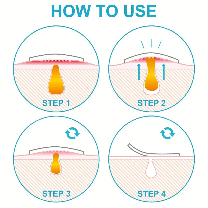 18pcs Microneedle Hydrocolloid Acne Patch Spot Stickers for Face