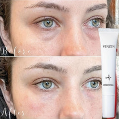 20g Hydrating Eye Cream Gentle Moisturizing And Firming Eye Cream