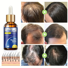 Hair Renewal Serum 30ml for Dry Damaged Hair Smoothes Hair