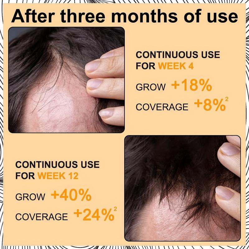 Rosemary Hair Care Essential Hair Care Serum Healthy Hair Penetrates
