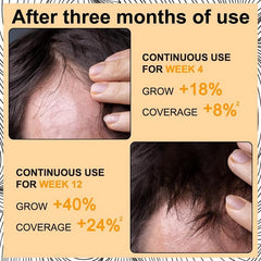 Rosemary Hair Care Essential Hair Care Serum Healthy Hair Penetrates