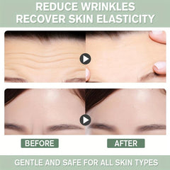 5 Pcs Forehead Smoothing Wrinkle Patches Fade Fine Wrinkles Moisturizing Pads