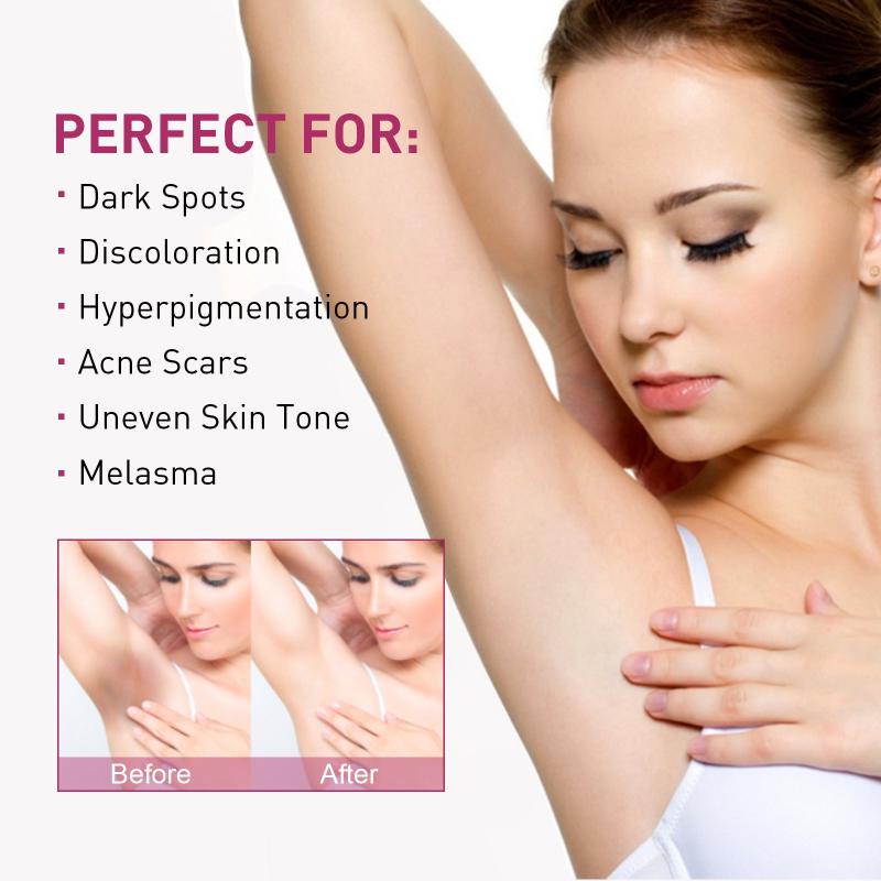 Underarm Repair Brightening Cream Moisturizes Softens Skin Illuminating Cream