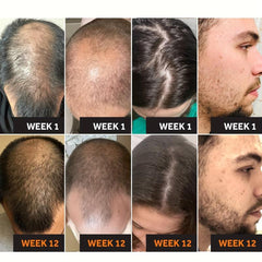 Hair Thicker Cream for Stronger Roots & Healthy Hair