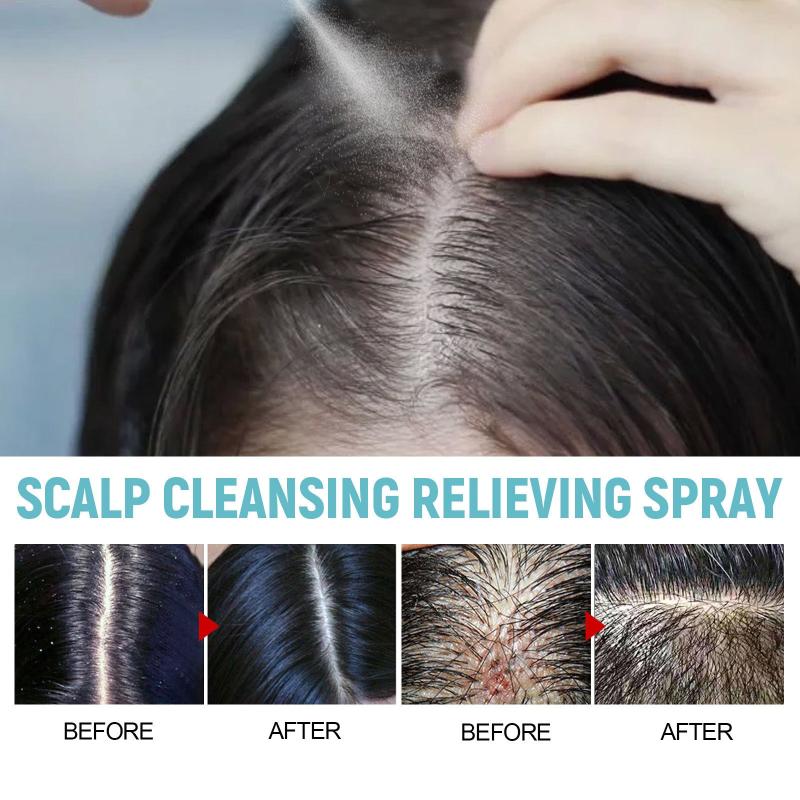 Scalp Cleansing Spray Plant Extraction Hair Care Repairing Spray