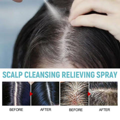 Scalp Cleansing Spray Plant Extraction Hair Care Repairing Spray