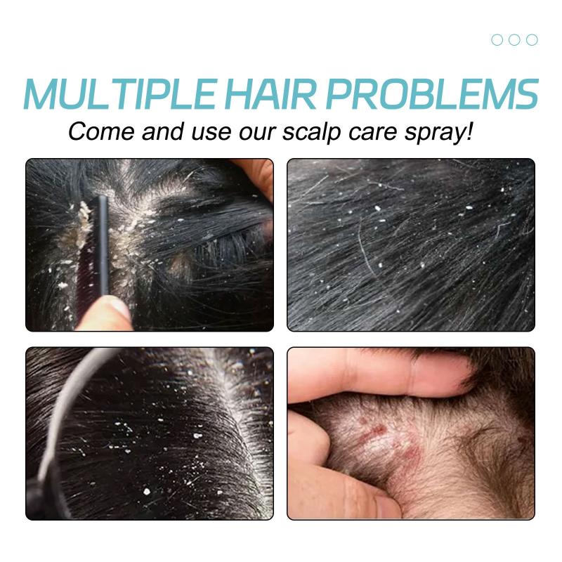 Scalp Cleansing Spray Plant Extraction Hair Care Repairing Spray