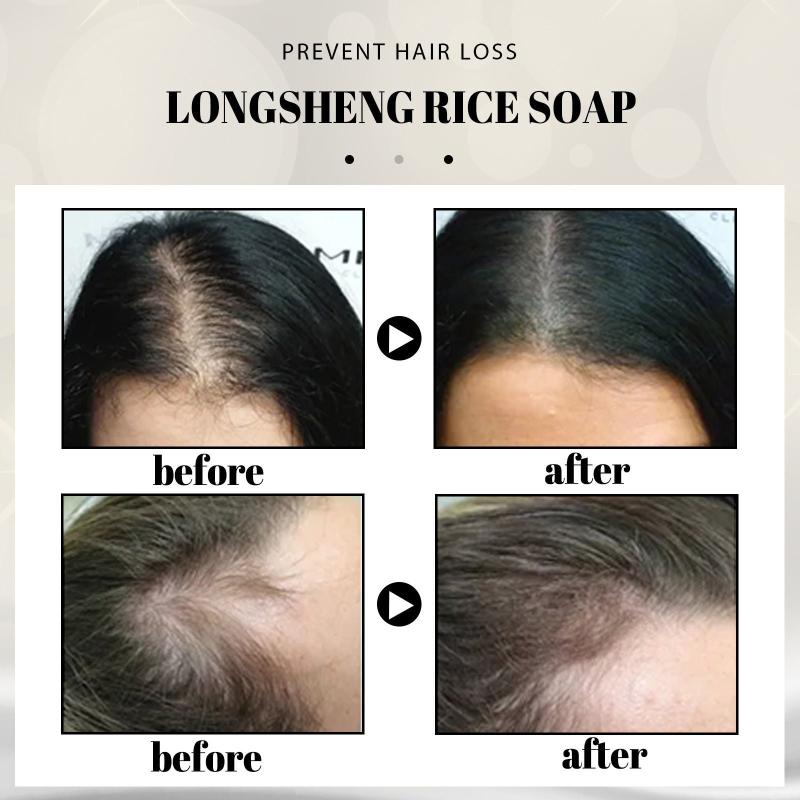 Natural Shampoo Bar Soap For Dry Damaged Hair