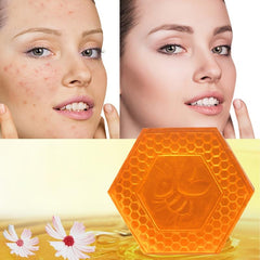 Nourishing Honey Soap for Dryness & Acne 80g