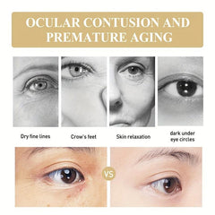 Eye Firming Cream Diminish Wrinkles Dark Circles Tighten Bags Improve Elasticity