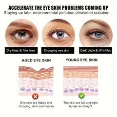 Retinol Eye Cream - Smooth Wrinkle Deep Nourishing - Moisturizing Firming