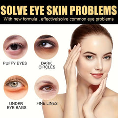20g Eye Cream Reduce Fine Lines Puffiness Dark Circles