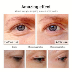 Eye Cream 20g Peptide Collagen Serum Wrinkle Diminishing Aging Resisting Remover