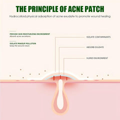 Acne Pimple Patch Stickers Invisible Blemish Spot Cover
