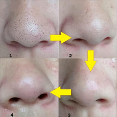 10 Pcs Blackhead Remover Mask Deep Cleansing Skin Care Pore Acne Caring Mask