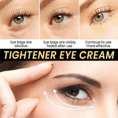 Moisturizing Eye Cream for Wrinkles, Dark Circles & Bags