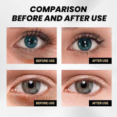 Moisturizing Eye Cream for Wrinkles, Dark Circles & Bags
