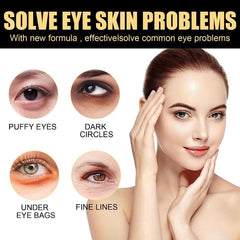 Moisturizing Eye Cream for Wrinkles, Dark Circles & Bags