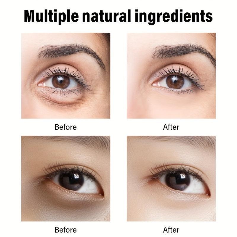 30g Retinol Eye Cream Dark Circles Bag Reduction Crow's Feet Smoothing