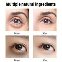 30g Retinol Eye Cream Dark Circles Bag Reduction Crow's Feet Smoothing