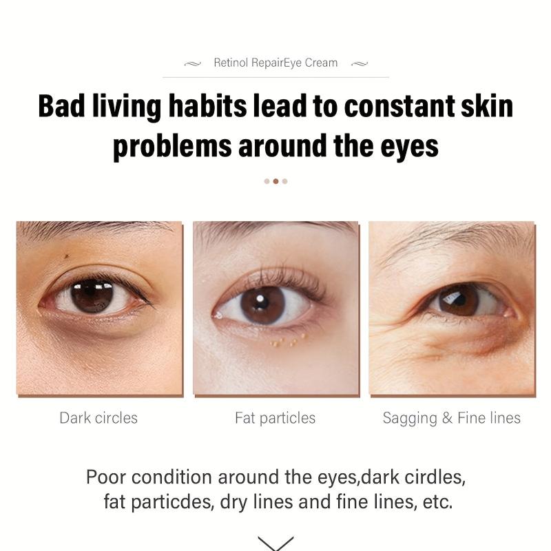30g Retinol Eye Cream Dark Circles Bag Reduction Crow's Feet Smoothing