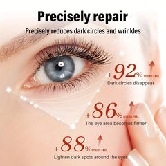 30g Retinol Eye Cream Dark Circles Bag Reduction Crow's Feet Smoothing
