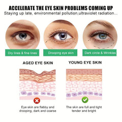 Anti-Aging Eye Cream for Dark Circles & Puffiness