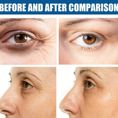 Moisturizing Under Eye Mask - Reduce Wrinkles, Improve Firmness