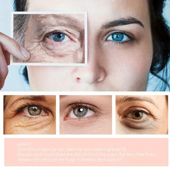 Hydrating Anti-Aging Eye Cream for Dark Circles, Puffiness, Wrinkles