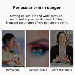 Bosein Peptide Eye Cream - Reduces Fine Lines, Circles, Eye Bags - Tightens Skin