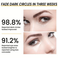 Eye Essence Cream for Dark Circles & Wrinkle Diminishing