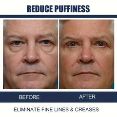 Dark Circle Eye Cream Reduce Wrinkles