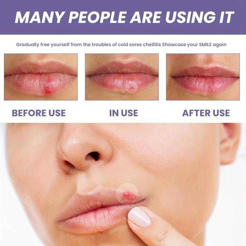 Moisturizing Lip Care Patch for Dry Lips