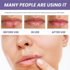 Moisturizing Lip Care Patch for Dry Lips