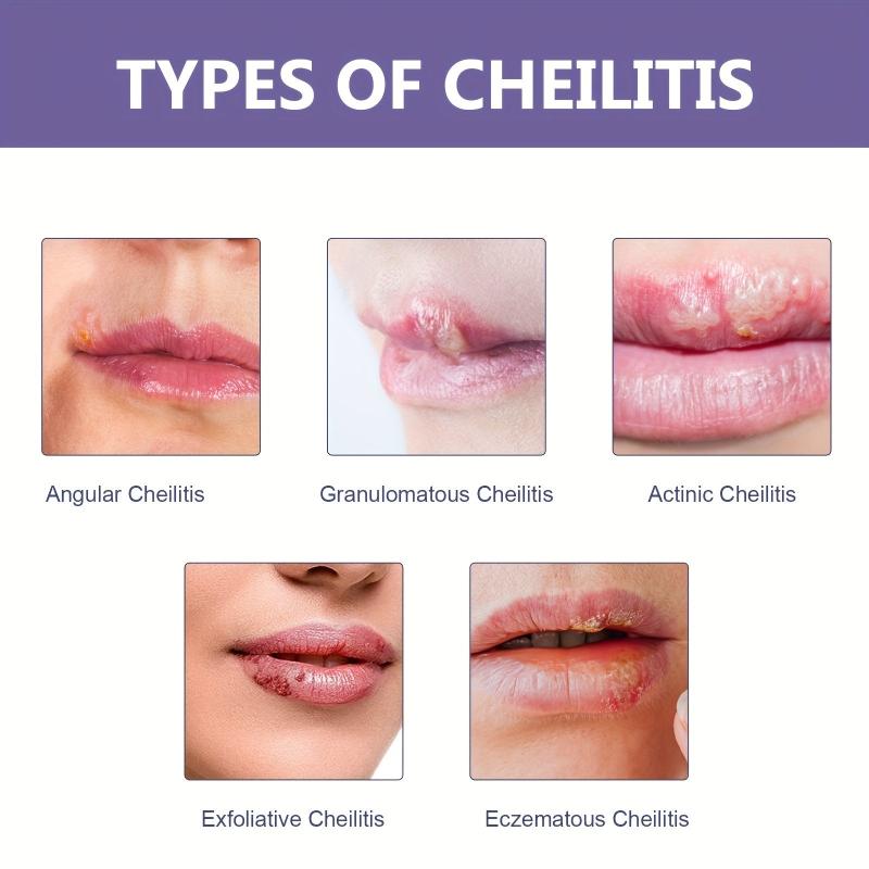 Moisturizing Lip Care Patch for Dry Lips