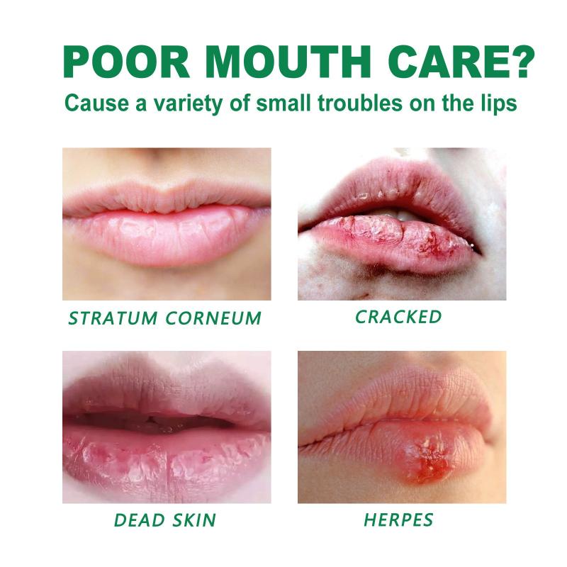 2Pcs 20g Herbal Lipstick Repairs Chapped Lips Moisturizes Lips